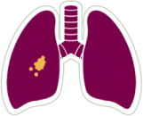 Lungs