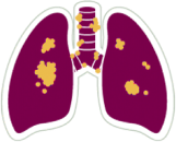 Lungs